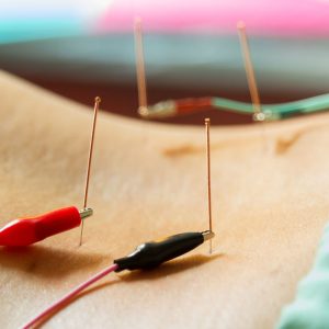 Electro Acupuncture treatment